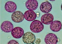 <p>type of pollen? </p>