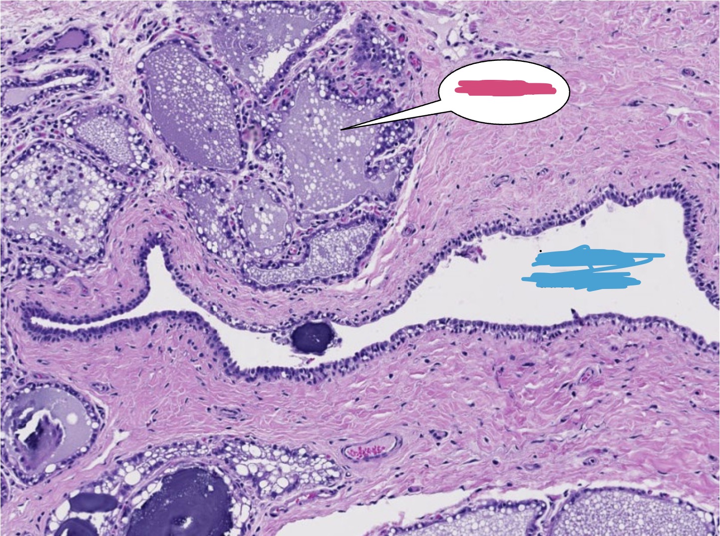 <p>Pictured is a bovine mammary gland, what structure is highlighted in pink?</p>