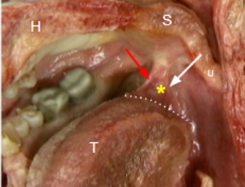 <p>Red: </p><p>White: </p><p>Yellow star: </p><p></p>