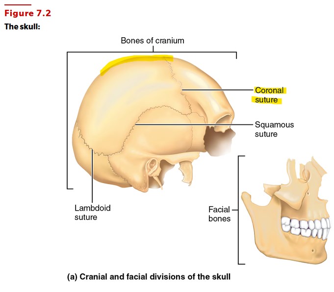 <p>Sagittal and Coronal (sagittal suture not pictured but it runs down midline of skull posterior from coronal suture)</p>