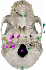<p>[1]</p>