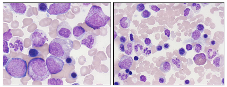 <p>Granulopoiesis</p>