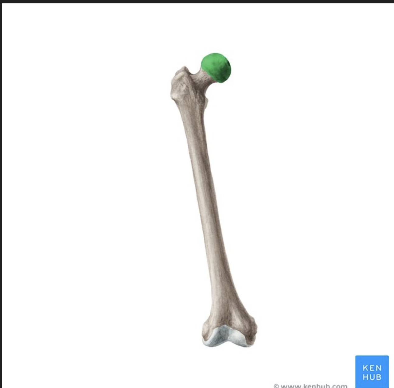 <p>Head Of Femur</p>