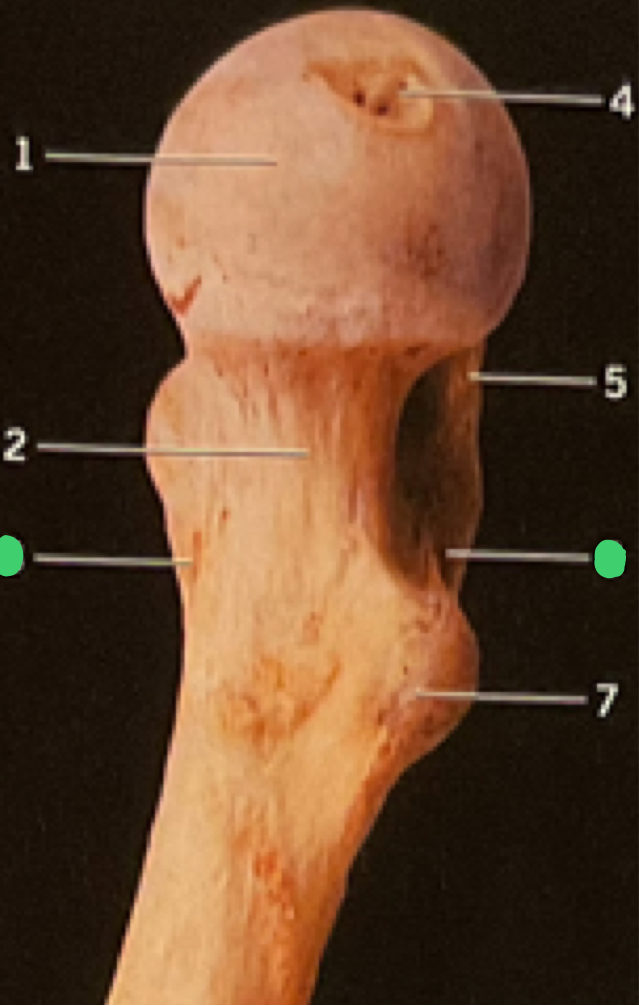 <p>2 (femur)</p>