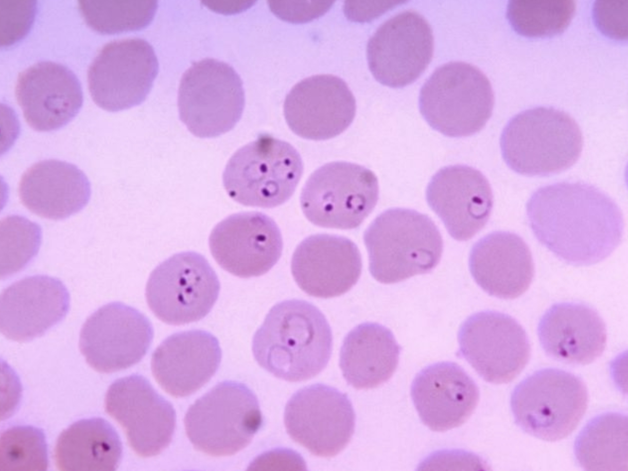 <p>What protist is this? (genus name)</p>