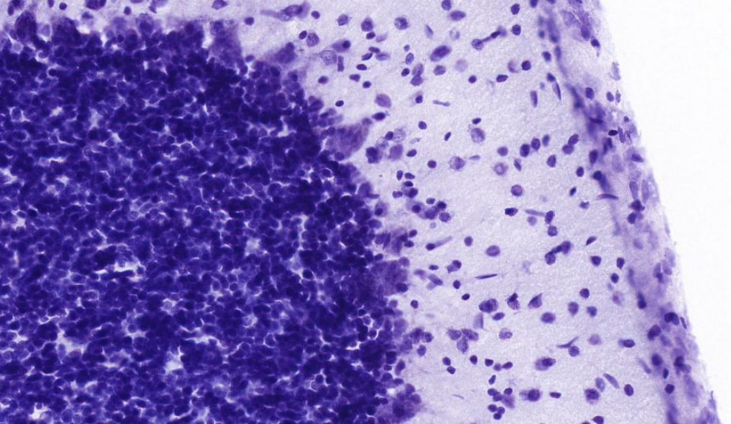 <p>Identifica la plaquita</p>