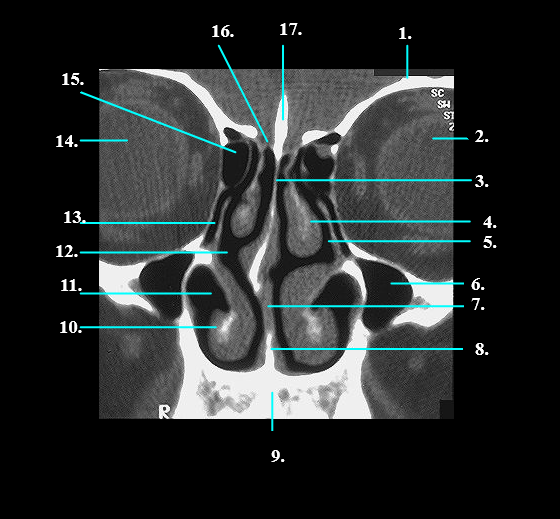 <p>Label 14 - 17</p>