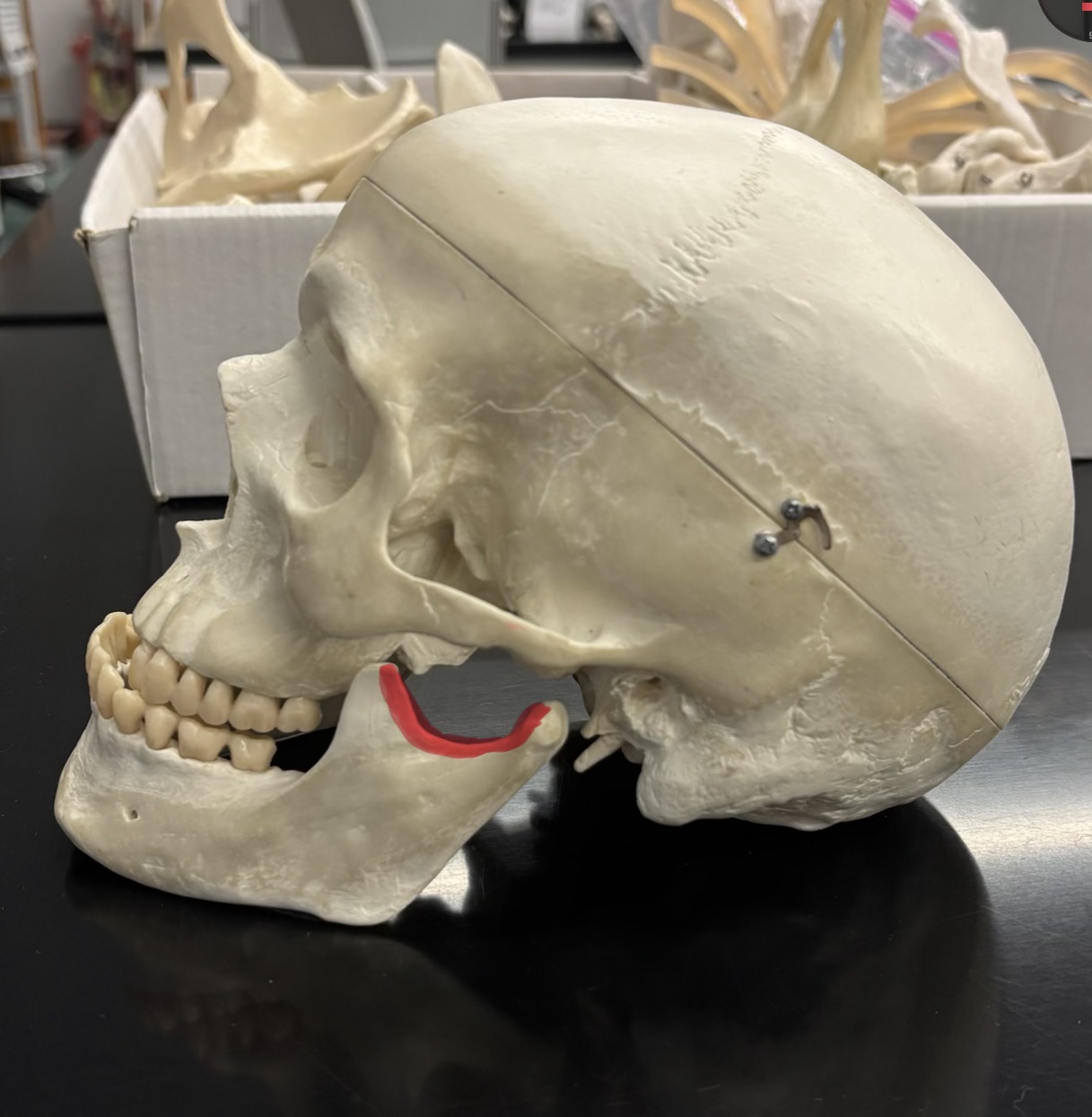 <p>What part of the skull is this</p>