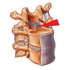 <p>name ligament and function</p>