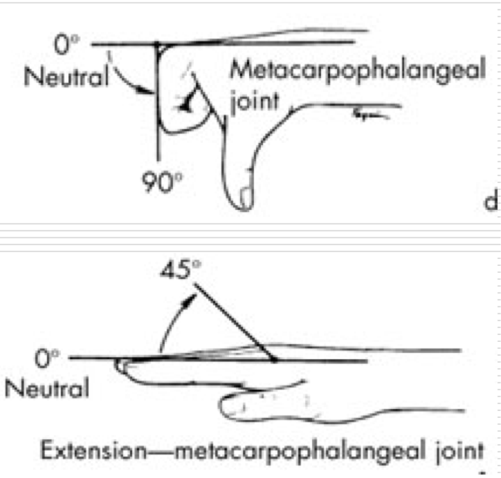<p>Between metacarpal and proximal phalanx </p><p>Condyloid (biaxial) Joint </p><ul><li><p>Flexion / Extension </p></li><li><p>Abduction / Adduction </p></li></ul><p></p>