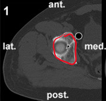 term image