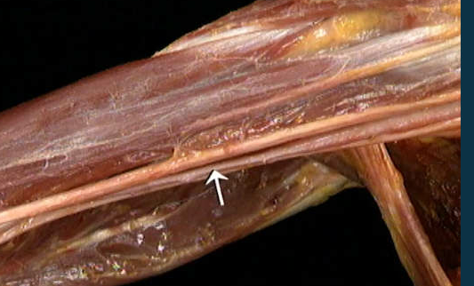 <p>Boven arm, arterië</p>