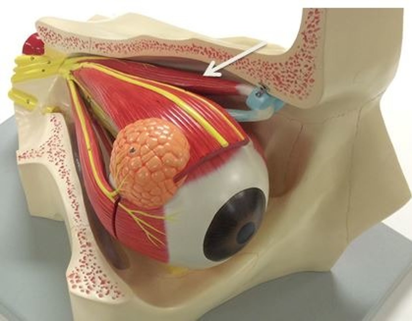 <p>Identify this muscle.</p>