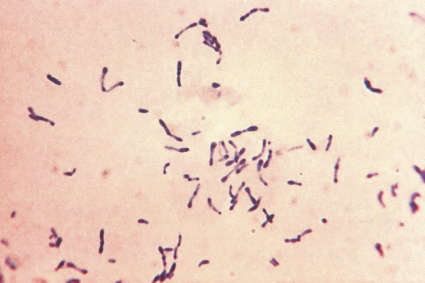 <p>What disease is caused by corynebacterium diphtheriae</p>