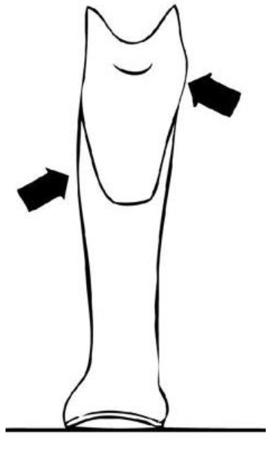 <p>proximal-medial, distal-lateral </p>