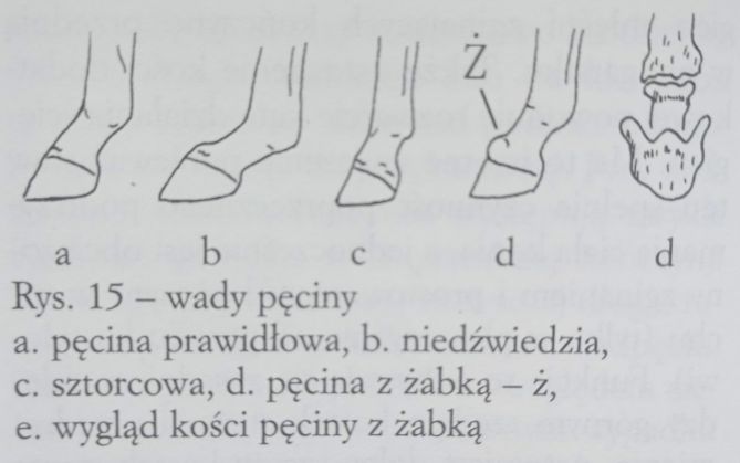 <p>niedźwiedzia</p><p>sztorcowa</p><p>z żabką (gnilne, bakteryjne zakażenie)</p>