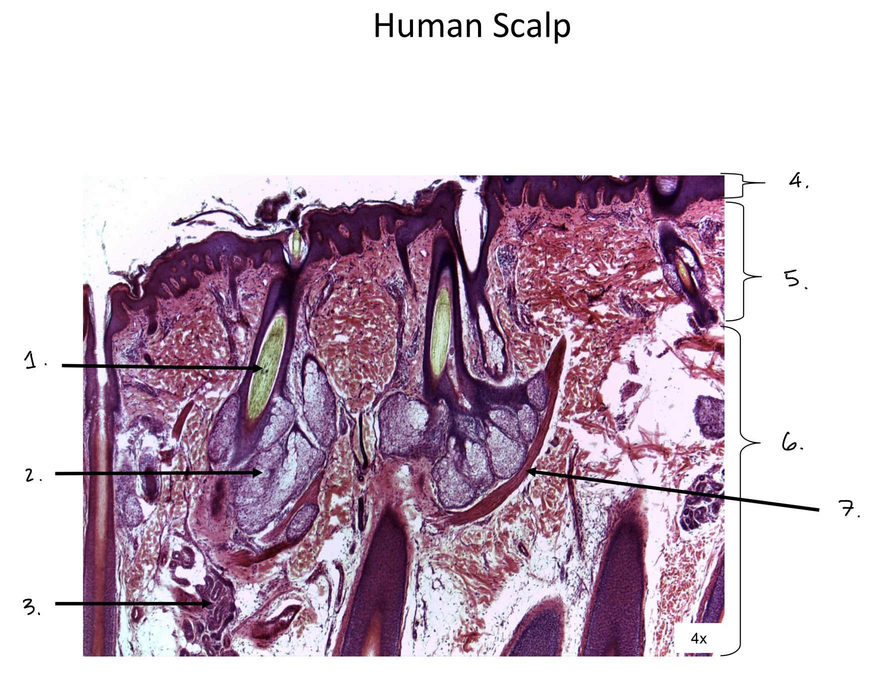 term image