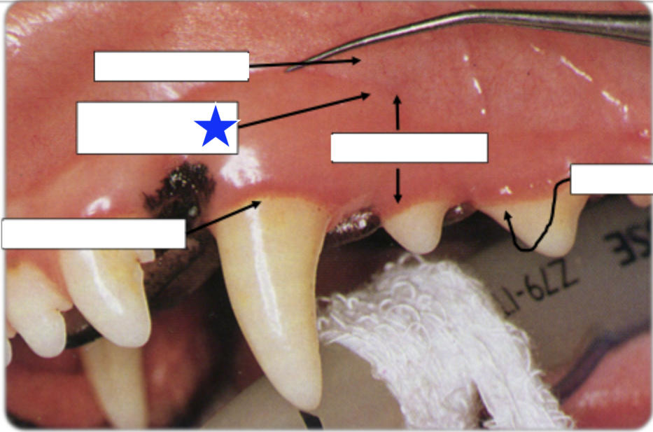 <p>What part of the gingiva is indicated by the star?</p>
