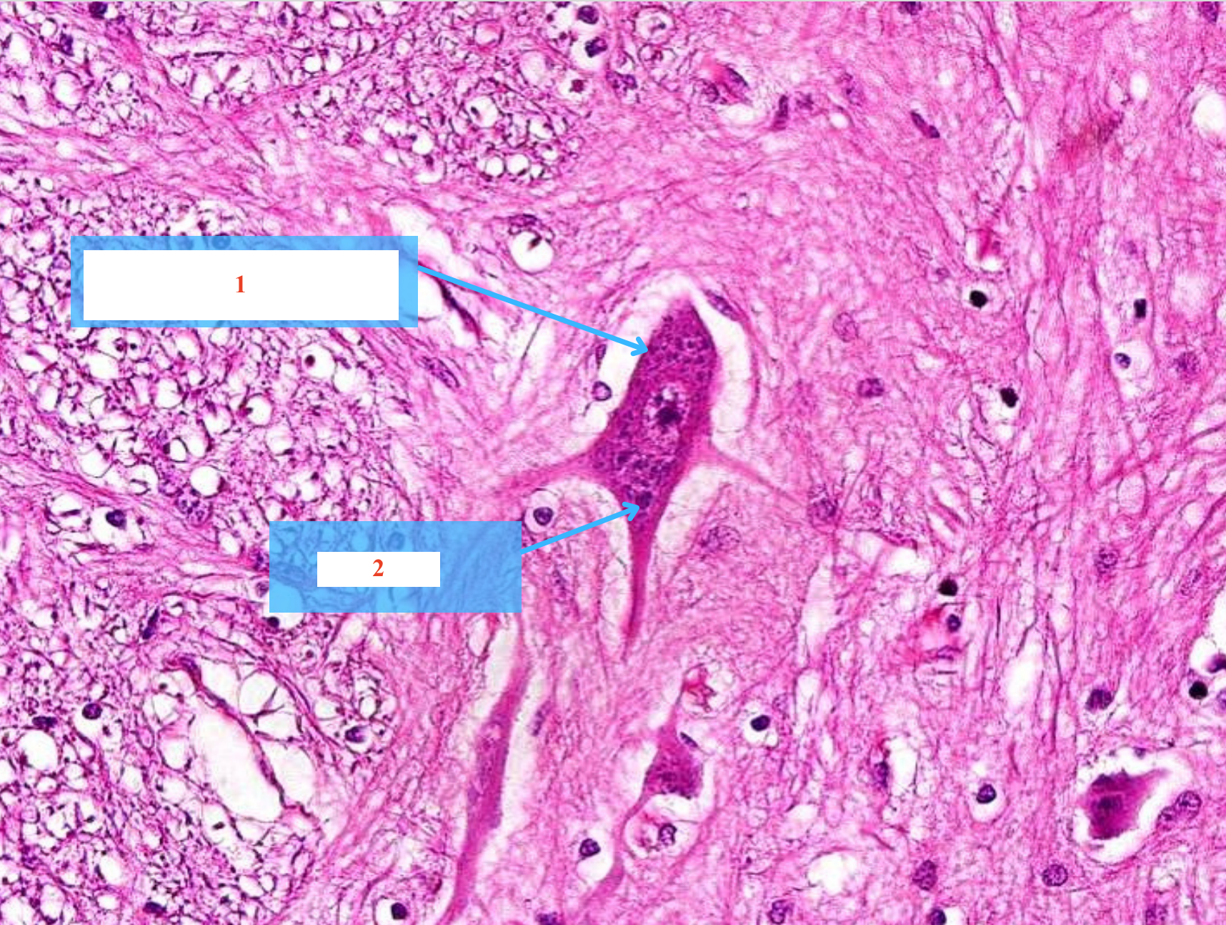 <p>Số 1 là tế bào gì ?</p><p>Số 2 là cấu trúc gì ?</p>