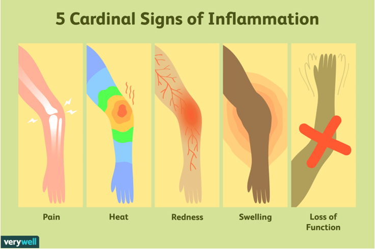 <p>Acute <br>signs and symptoms</p>