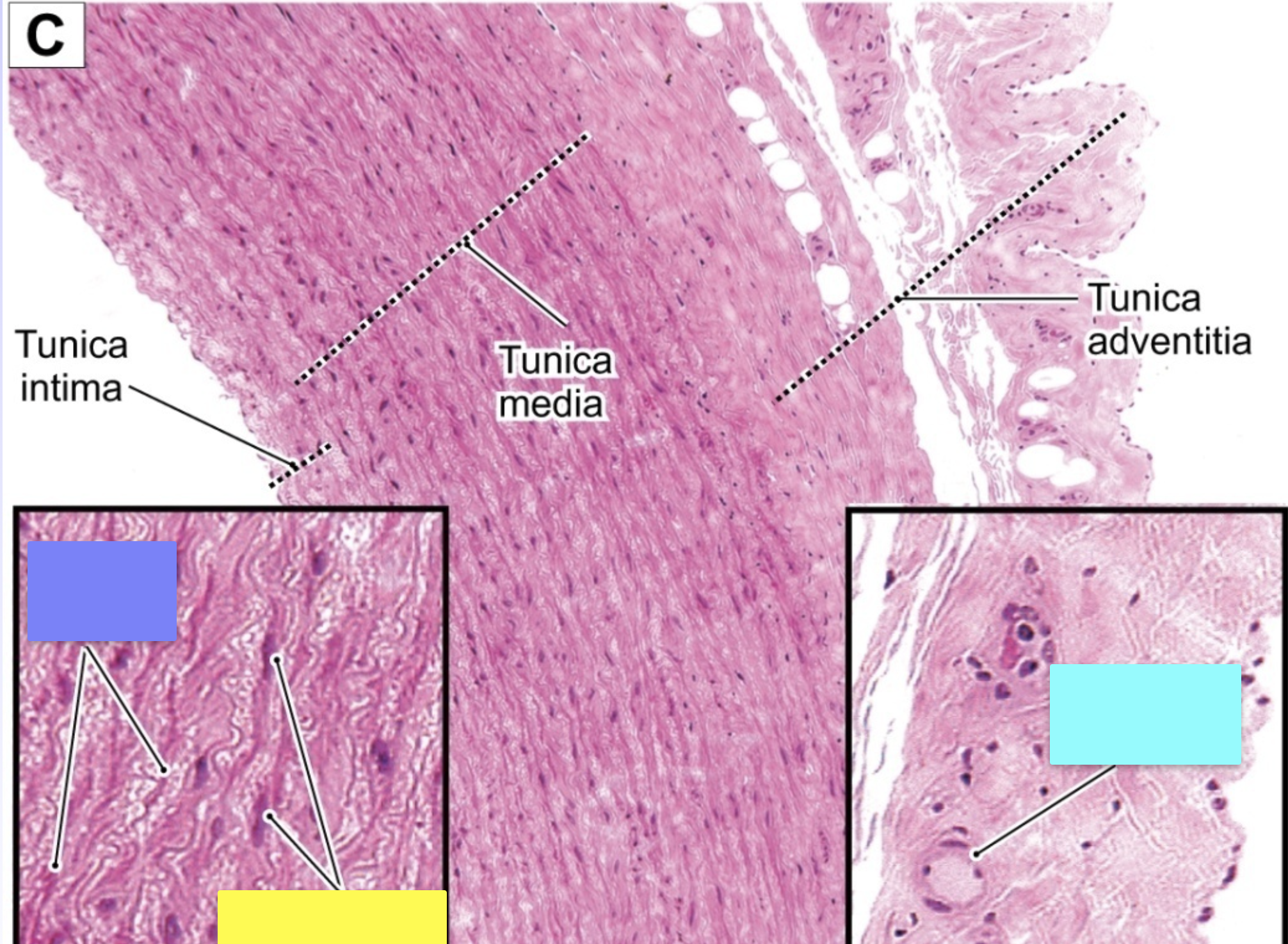 <p>large artery </p>
