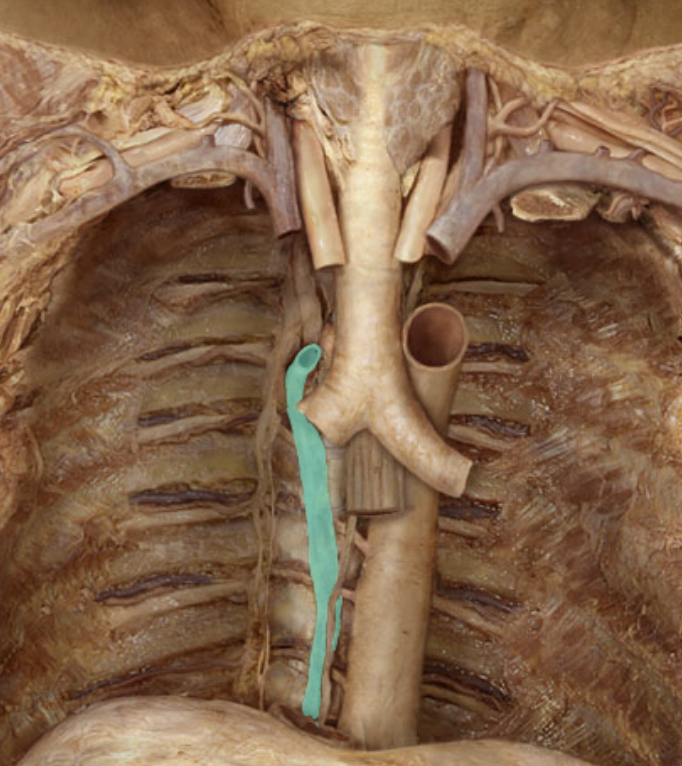 <p>Identify the feature of the caval system</p>