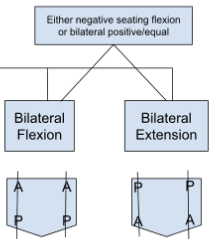 <ul><li><p>(-) seated flexion OR bilateral (+)/equal</p></li><li><p>extension → sulci post., ILA ant.</p></li><li><p>flexion → sulci ant., ILA post.</p></li></ul><p></p>