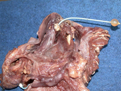 <ul><li><p>Salpinx / salpingitis</p></li><li><p>Guttural tympany (air)</p><ul><li><p>Due to obstruction of outflow via the auditory tube</p></li></ul></li><li><p>Empyema (pus)</p></li><li><p><em>Aspergillus</em> infection</p><ul><li><p>Especially on the dorsal and caudal wall</p></li></ul></li><li><p>Carotid hemorrhage</p><ul><li><p>Important complication</p></li></ul></li></ul><p></p>
