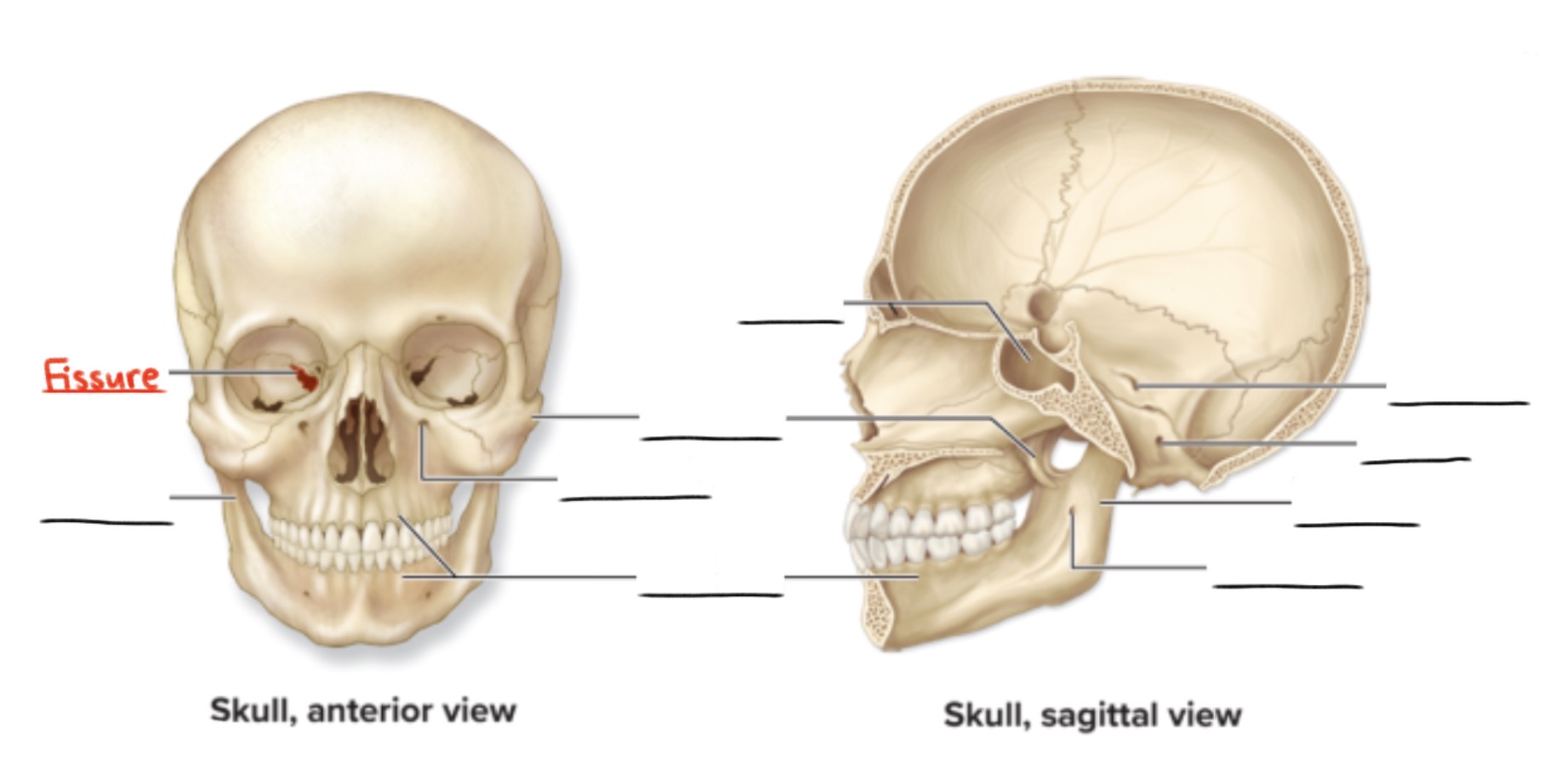 <p><strong>Fissure</strong></p><p>Narrow, slitlike opening through a bone</p><p>(Openings and spaces)</p>