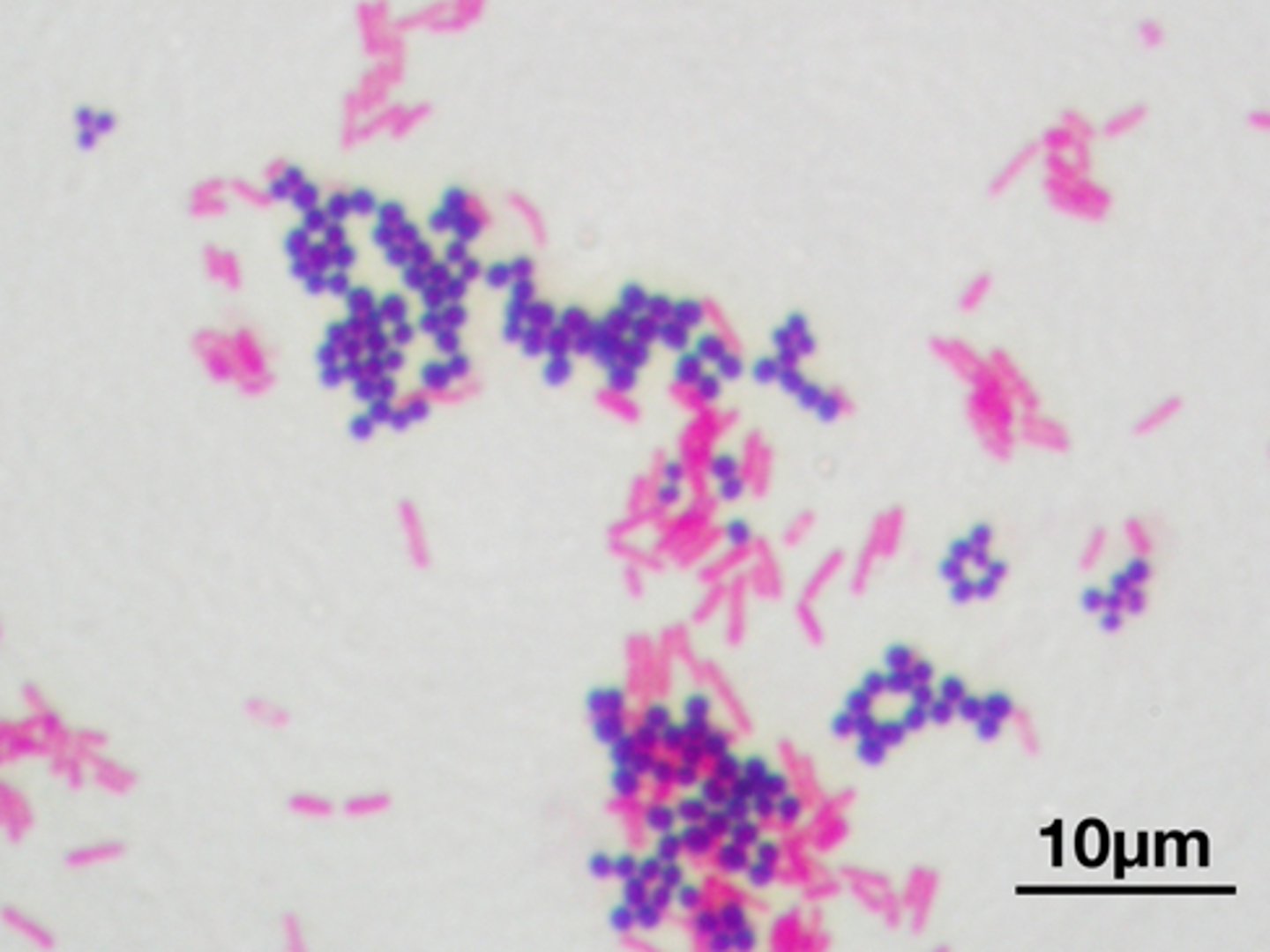 <p>cell wall (gram +), (gram -)</p>