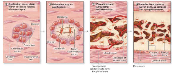 <p>-<strong>Ossification centers form </strong>w/in thickened regions of mesenchyme starting @~8th wk of development </p><ul><li><p>Some cells become osteoprogenitor cells, or osteoblasts secreting osteoid </p></li></ul><p>-Osteoid Undergoes <strong>calcification </strong></p><ul><li><p>(Ca2+ salts deposit onto osteoid & crystalize & the entrapped cells become osteocytes)</p></li></ul><p>-<strong>Woven </strong>bone (primary) & surrounding <strong>periosteum </strong>form </p><ul><li><p>Bone is immature & poorly organized until the mesenchyme around the woven forms periosteum </p></li></ul><p>-Lamellar bone replaces woven bone, as compact & spongy bone forms </p><ul><li><p>compact & spongy bone form from trabeculae</p></li><li><p>this is the typical structure of a flat cranial bone (2 external layers of compact bone & a layer of spongy bone in between)</p></li></ul><p></p>