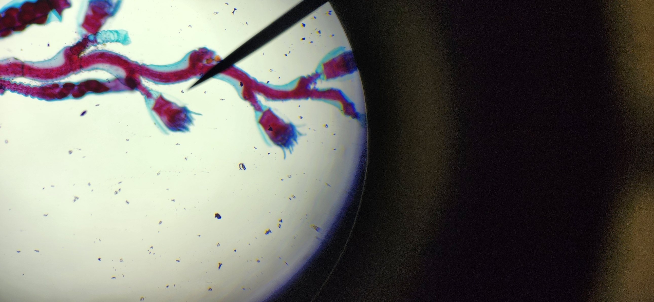 <p>Look at the Obelia hydroids</p>