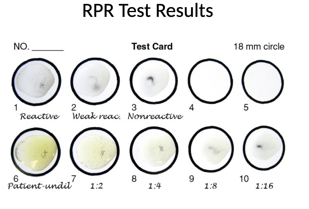 <ul><li><p>patient serum mixed on a card with charcoal particles with cardiolipin antigen</p></li><li><p>observe for macroscopic flocculation</p></li></ul><p></p>