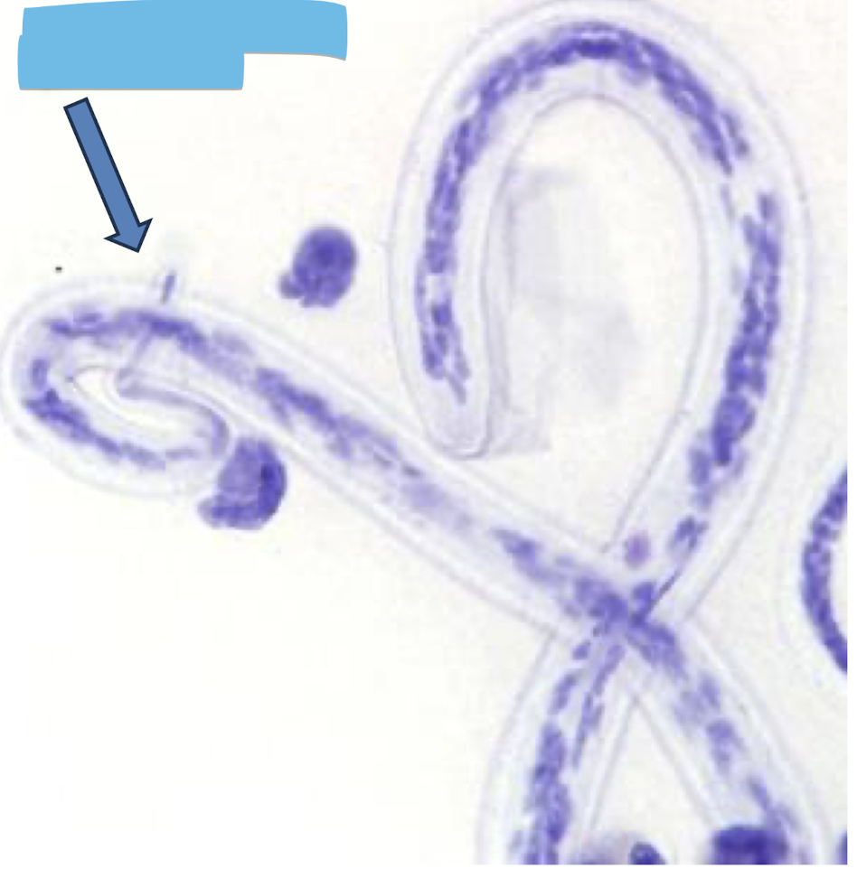 <p>What parasite is this?</p>