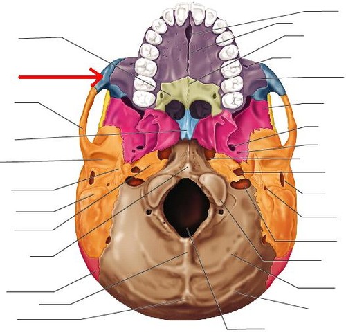 term image