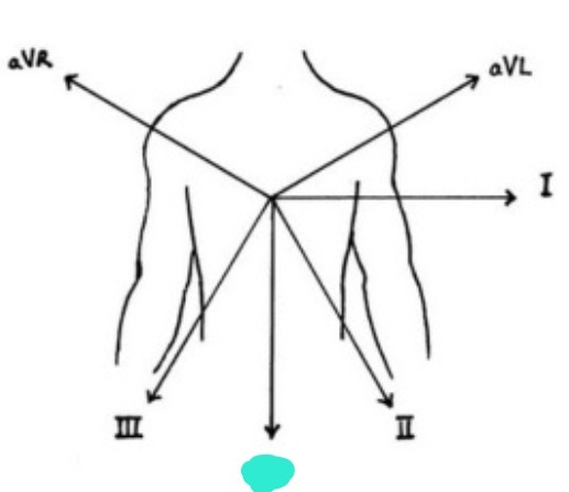 <p>left leg &amp; right arm/left arm 흘러가는 전기적 흐름 보여줌</p>