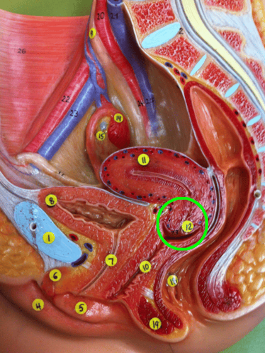 <p>narrow neck which projects into the vagina inferiorly</p>