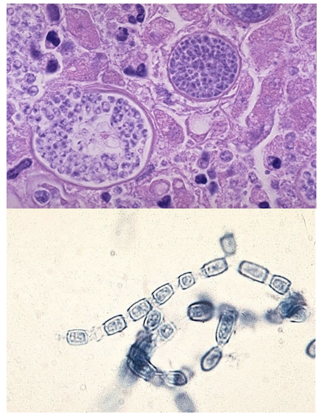 <p>-Spherule form at 47%</p><p>-Mold form</p><ul><li><p>Hyaline,* septate with “Train tract”), arthroconidia</p></li></ul><p></p>