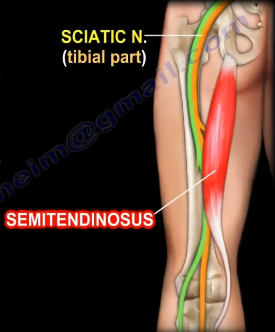 <ul><li><p>function:</p></li></ul><p>- extends thigh and flexes leg at the knee joint</p><p>- medially rotates leg when flexed at knee</p><p></p><ul><li><p>innervation: Tibial division of <span style="color: red;">sciatic nerve</span> (L4-S1 fibers)</p></li></ul><p></p><ul><li><p>Attachments:</p></li></ul><p>P: Ischial tuberosity</p><p>D: Proximal medial surface of <span style="color: red;">tibia</span></p><p></p><p></p><p></p>