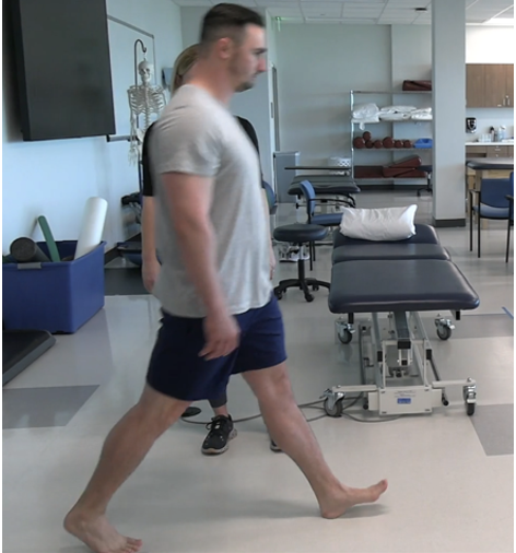 <p><strong>Purpose: </strong>Extra-articular Hip Pathology</p><ul><li><p><span style="color: red;"><strong>IschioFemoral Impingement (IFI)</strong></span></p></li><li><p><span style="color: red;"><strong>Proximal Hamstring Tendinopathy (PHT)</strong></span></p></li></ul><p><br><strong>How to Perform:</strong> </p><ol><li><p>Pt standing</p></li><li><p>Have pt take a long step forward with non-test leg so test leg trails behind in extension</p></li><li><p>Check pain on extended test leg</p></li><li><p>Repeat with test leg and firm heel strike forward to mimic terminal stance → initial contact transition<br></p></li></ol><p><strong>Positive Test:</strong></p><ul><li><p><strong>Deep buttock or posterior hip pain</strong> (broad deep ache near or lateral to the ischium) when the <strong>trailing leg extends </strong>→ <span style="color: red;"><strong>IschioFemoral Impingement (IFI)</strong></span></p><ul><li><p>Mechanism: Compression of the <strong>quadratus femoris</strong> between the <strong>ischial tuberosity</strong> and <strong>lesser trochanter </strong>during hip extension/adduction</p></li></ul></li><li><p><strong>Localized pain directly at the ischial tuberosity</strong> or proximal hamstring origin during forward heel strike → <span style="color: red;"><strong>Proximal Hamstring Tendinopathy (PHT)</strong></span></p><ul><li><p>Mechanism: Rapid <strong>eccentric hamstring loading</strong> during <strong>terminal swing → initial contact</strong> as the hamstrings decelerate the limb</p></li></ul></li><li><p>Pain relieved when stride is shortened → <span style="color: red;"><strong>IFI or PHT, but IFI more likely</strong></span></p><ul><li><p>Mechanism: Shortening the stride reduces hip extension and decreases quadratus femoris compression</p></li></ul></li><li><p>Pain worsens with faster walking or running → <span style="color: red;"><strong>PHT more likely</strong></span></p><ul><li><p>Mechanism: Increased walking/running speed increases eccentric demand on the hamstrings</p></li></ul></li></ul><p></p><p><strong>Interpretation:</strong> </p><ul><li><p>Hip hyperextension narrows ischiofemoral space, stressing quadratus femoris and proximal hamstring tendon</p></li><li><p>Symptoms can mimic proximal hamstring tendinopathy or sciatic nerve irritation</p></li></ul><p></p>
