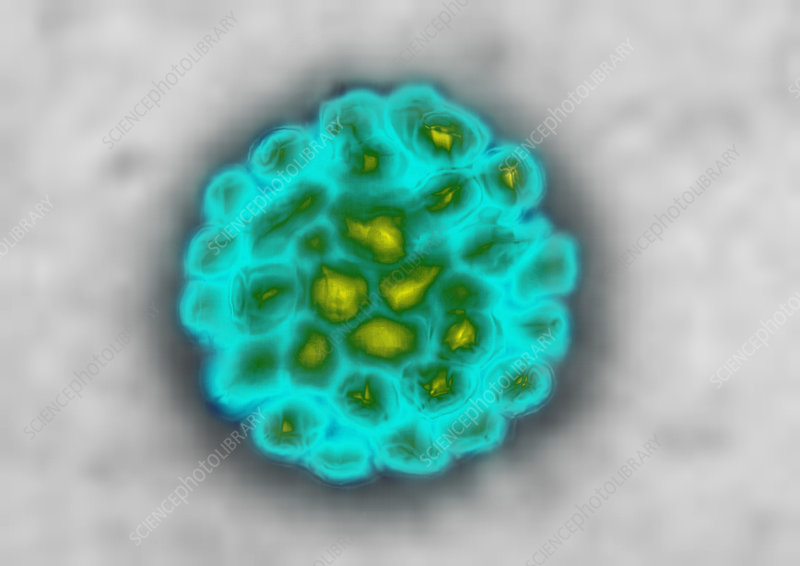 <p>Naked icosahedral</p>
