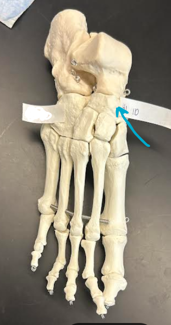 <p>ID foot region</p>