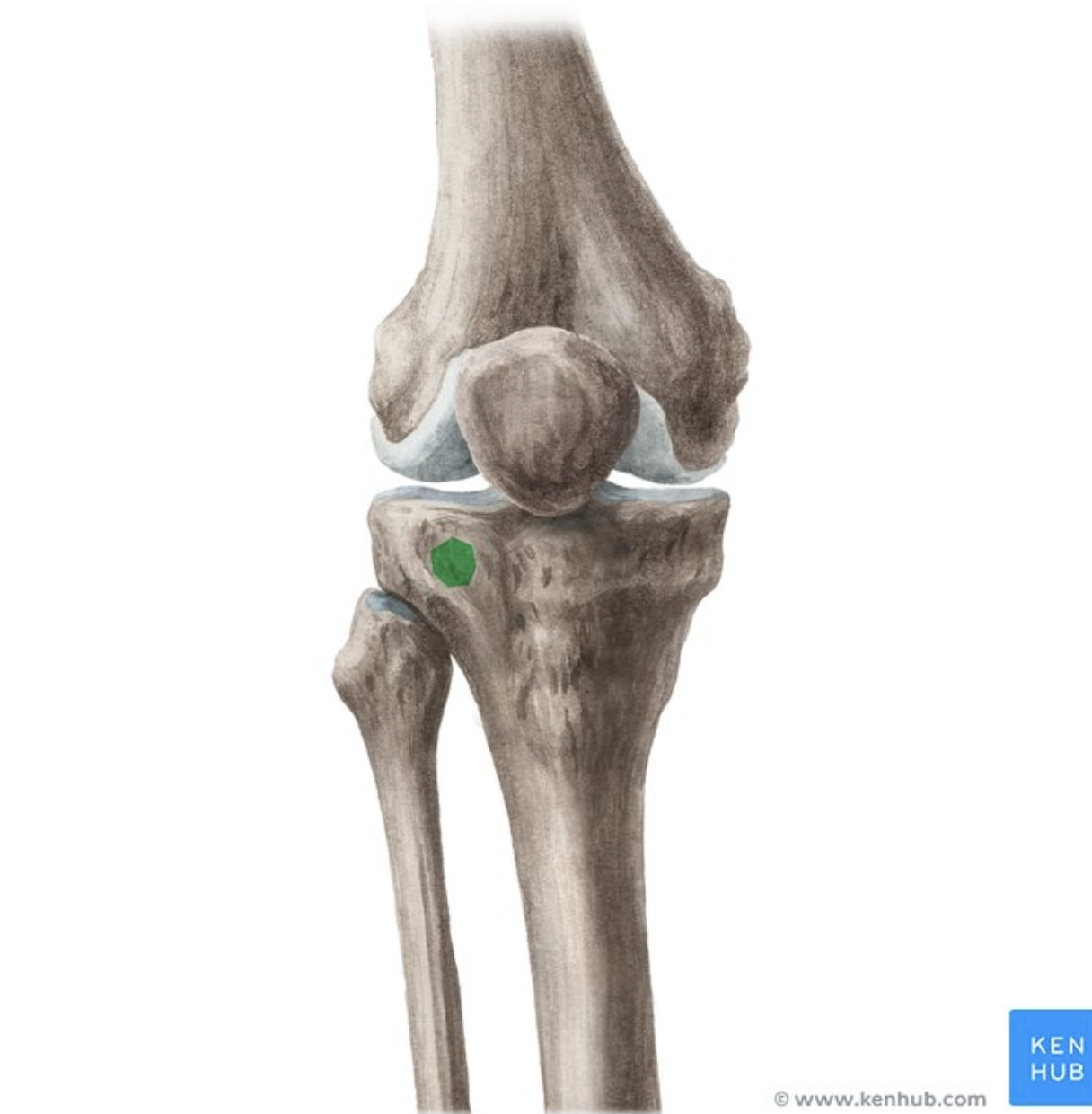 <p>Tubercle of iliotibial tract</p>