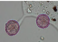 <p>What type of pollen? </p>