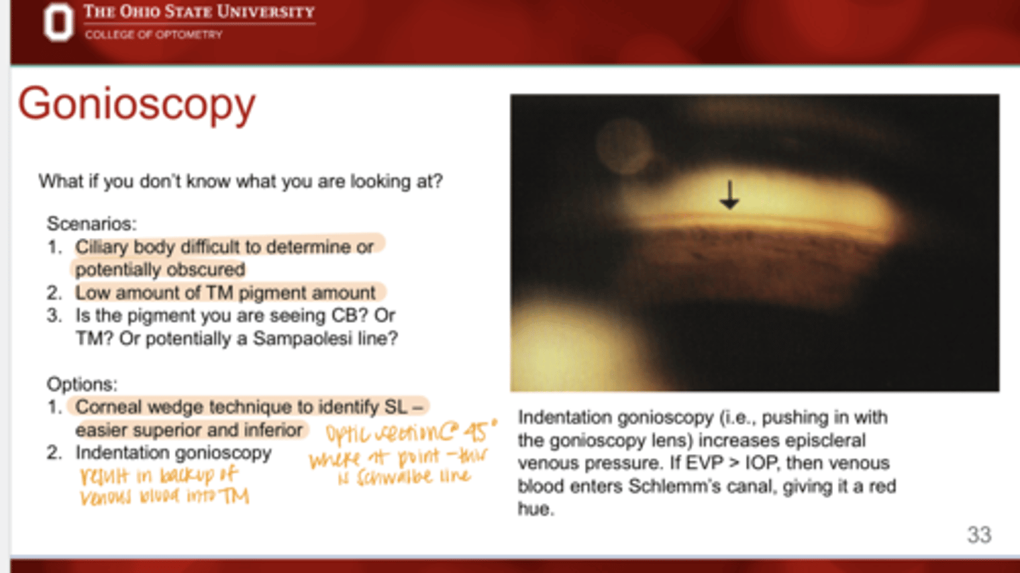 <p>How to perform Indentation gonioscopy?</p>