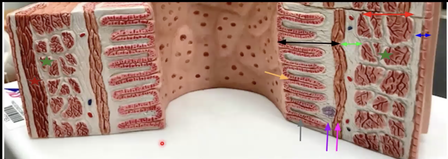 <p>What organ is this? Identify. Function of organ and function of color orange</p>