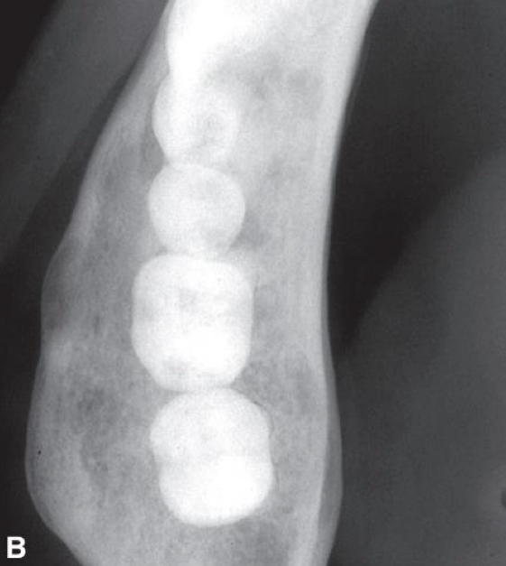 <p>enlarges bone but maintains bone shape</p>