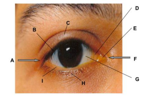 <p>label the outer eye and lid </p>