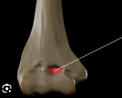 <p>Which bone is this?</p>