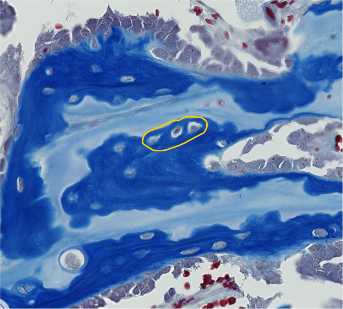 <p><span style="font-family: "Calibri Light";">ID the encircled bone cells.</span></p>